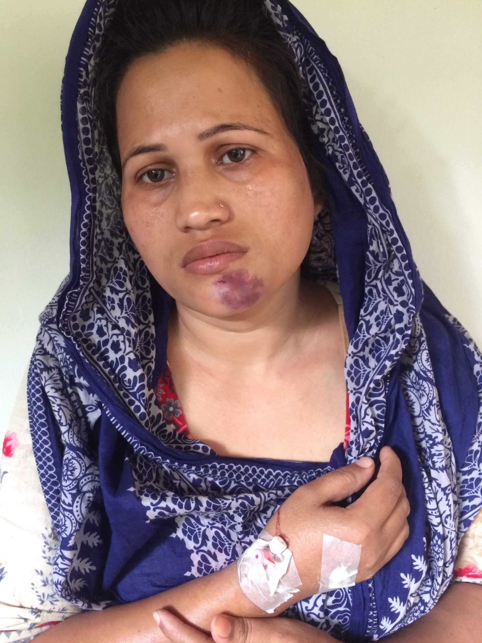শ্রীপুরে জমি নিয়ে প্রতিপক্ষের হামলায় নারী সহ আহত ৪