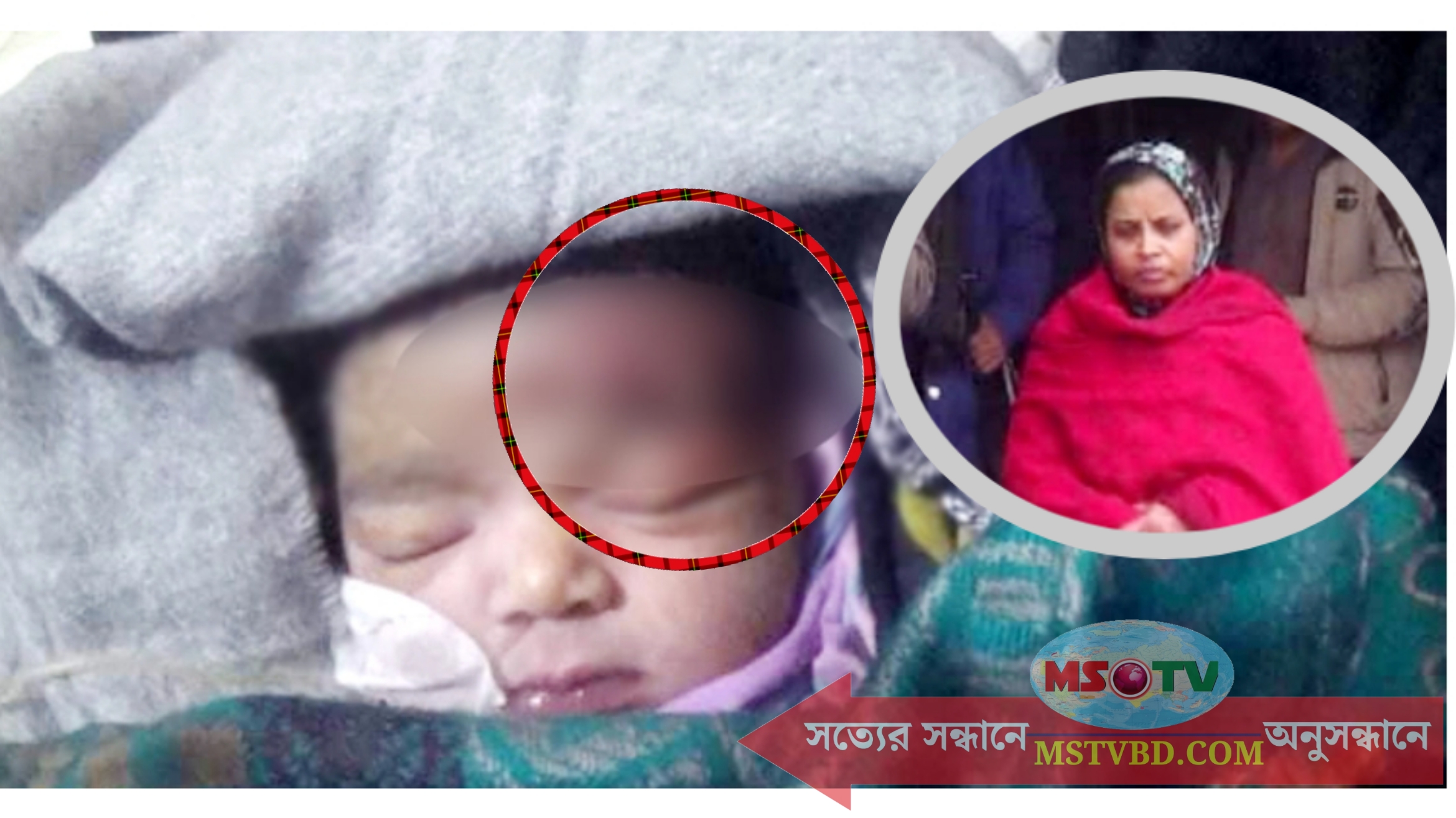 ফরিদপুরে সিজার করলেন আয়া-নার্স, নবজাতকের কপালে ৯ সেলাই