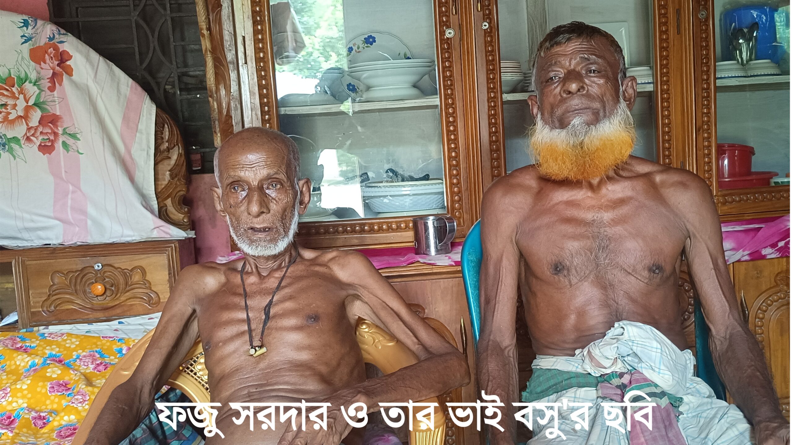 বিভিন্ন রোগে আক্রান্ত হয়ে জীবন মৃত্যুর সন্ধিক্ষণে দাঁড়িয়ে মইনপুরের ফজু সরদার