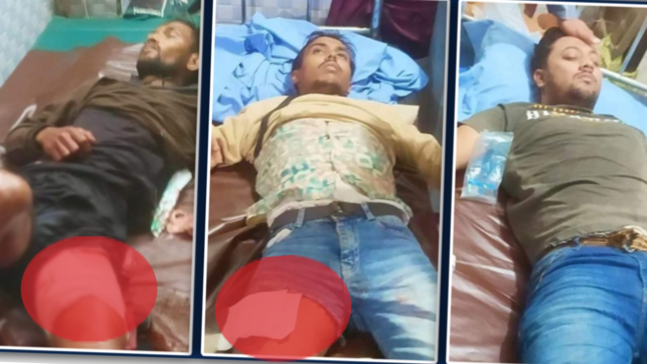কক্সবাজারের পেকুয়ায় পুলিশ-বিএনপি সংঘর্ষ, গুলিবিদ্ধ ৫
